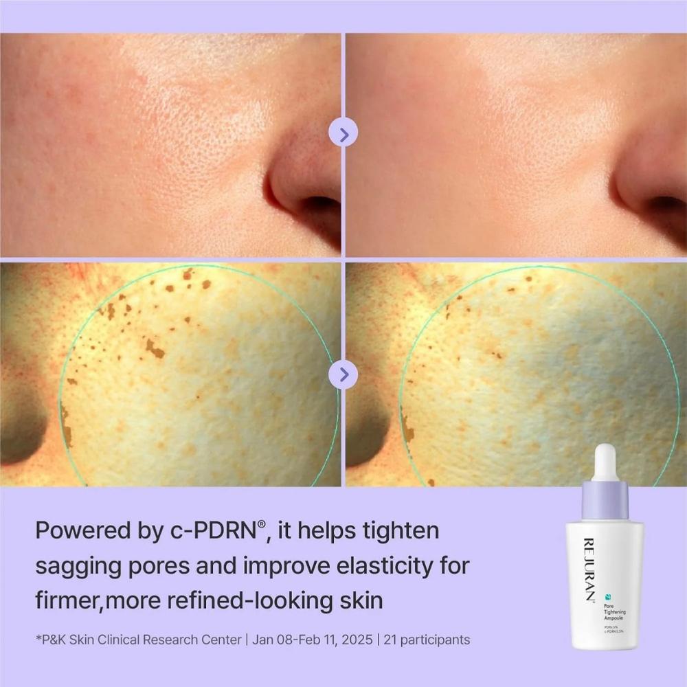 Rejuran Derma Healer Ampolla Rassodante Pori 30ml / 1.01 fl. oz