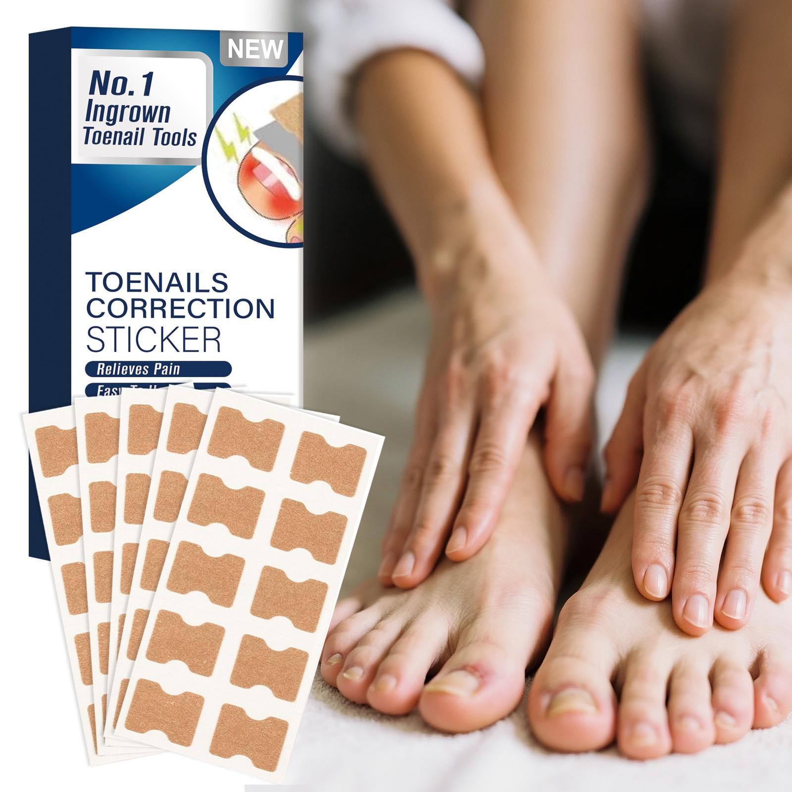 

Дышащий пластырь для коррекции без клея для облегчения боли и коррекции ногтей на ногах 1*50шт One Size