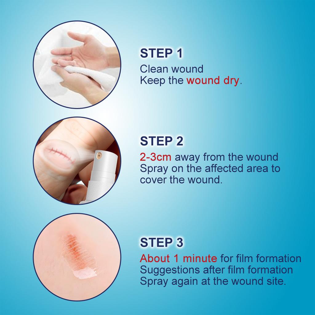 Body Care Spary For Diabetic Care , Soothing Swelling, Itching And Pain 30ml