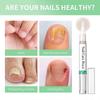 Nail Care Pen - Original Austrian Formula with Tea Tree Oil, Vitamin E & Aloe Vera for Nail Fungal Infection Treatment, Portable Nail Fungus Pen