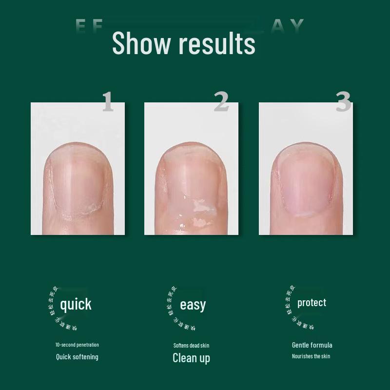 Nail Care Set: Shiny, Nourishing Cuticle Softener & Long-Lasting Polish for Salon-Quality Results
