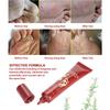 15g Natural Plant Foot Treatment Cream Moisturizer Feet Ointment Anti Fungal Relieving Itching
