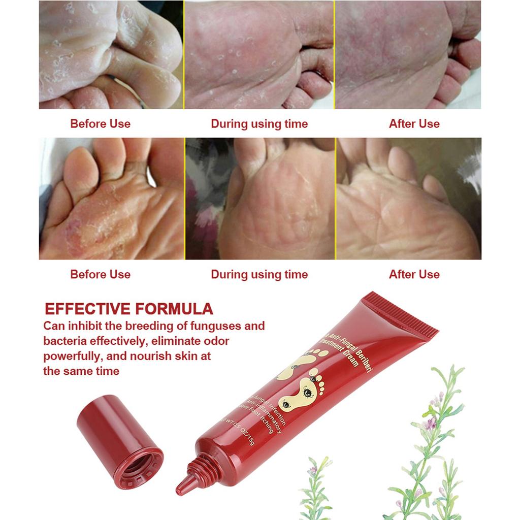 15g Natural Plant Foot Treatment Cream Moisturizer Feet Ointment Anti Fungal Relieving Itching