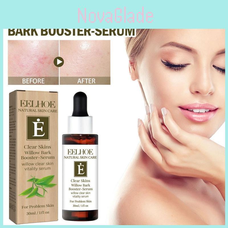 Eelhoe Clear Skin Willow Bark Essence Nourishing Moisturizer For Dry Skin And Acne Scars