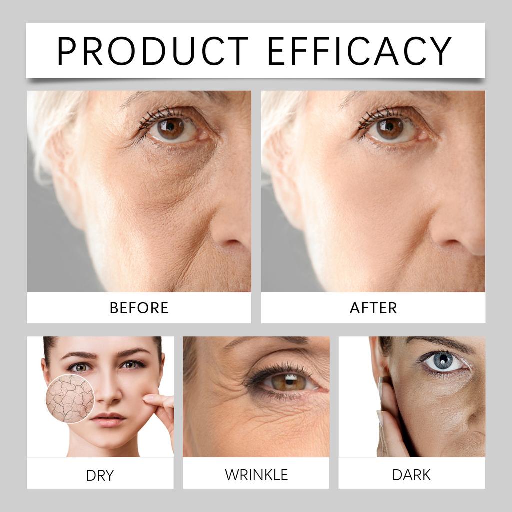 Serum Redukujące Zmarszczki I Ujędrniające Uzupełnia I Redukuje Zmarszczki, Rewitalizuje I Napina Skórę, Odżywia Skórę I Zwalcza Starzenie, 30ML