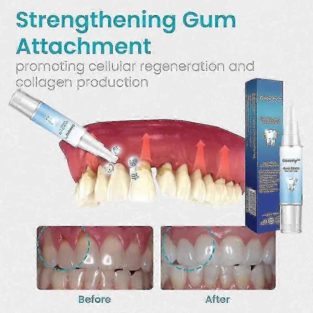 3pcs Gum Repair Gel Rebuilding Strengthen Whiten Remove Breath Inflammation Oral Tooth Bad Protect Anti Gingival Stains Recessio