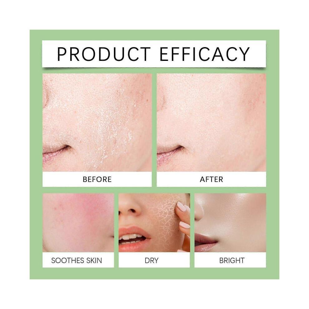 Anua Azelaic Acid 10 Hyaluron Redness Soothing Serum, Facial Serum for Sensitive Skin, Hyaluronic Acid, Niacinamide, Spot Care