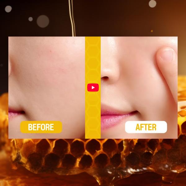 HOLIKA HOLIKA Honig Royalactin Propolis Ampullen Spezialset (Ampulle 30 ml / 1,01 fl.oz., Creme 25 ml / 0,84 fl.oz.) fl.oz. (3 Optionen)