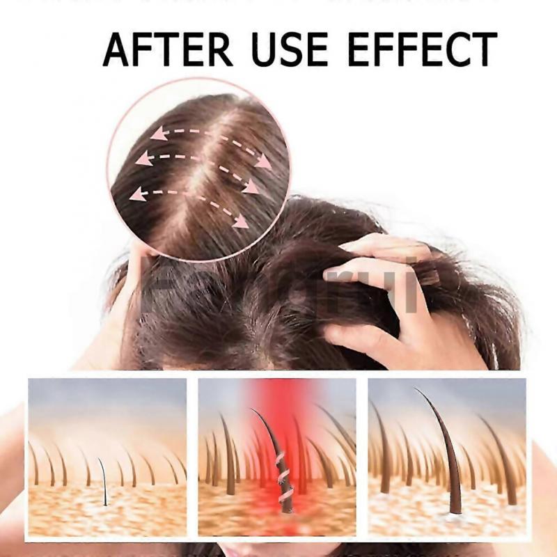 For Boost Hair Serum For Hair Growth Thickening Nourishing Scalp Treatment With Polygonum Multifloru