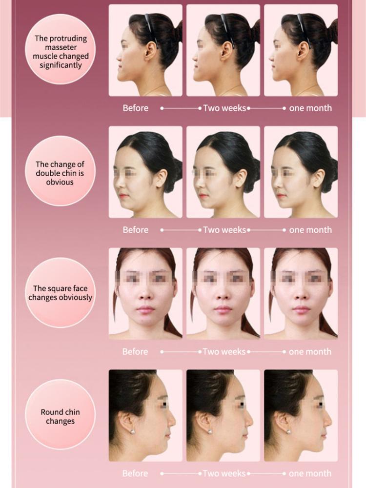 Facial Lifting Device LED Photon Therapy Facial Slimming Vibration Massager Double Chin V-shaped Cheek Lift Face