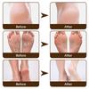 15g Cracked Heel Treatment Cream Repairing Feet Anti-Dry Cracked Peeling Chapped Moisturizing Foot Cream