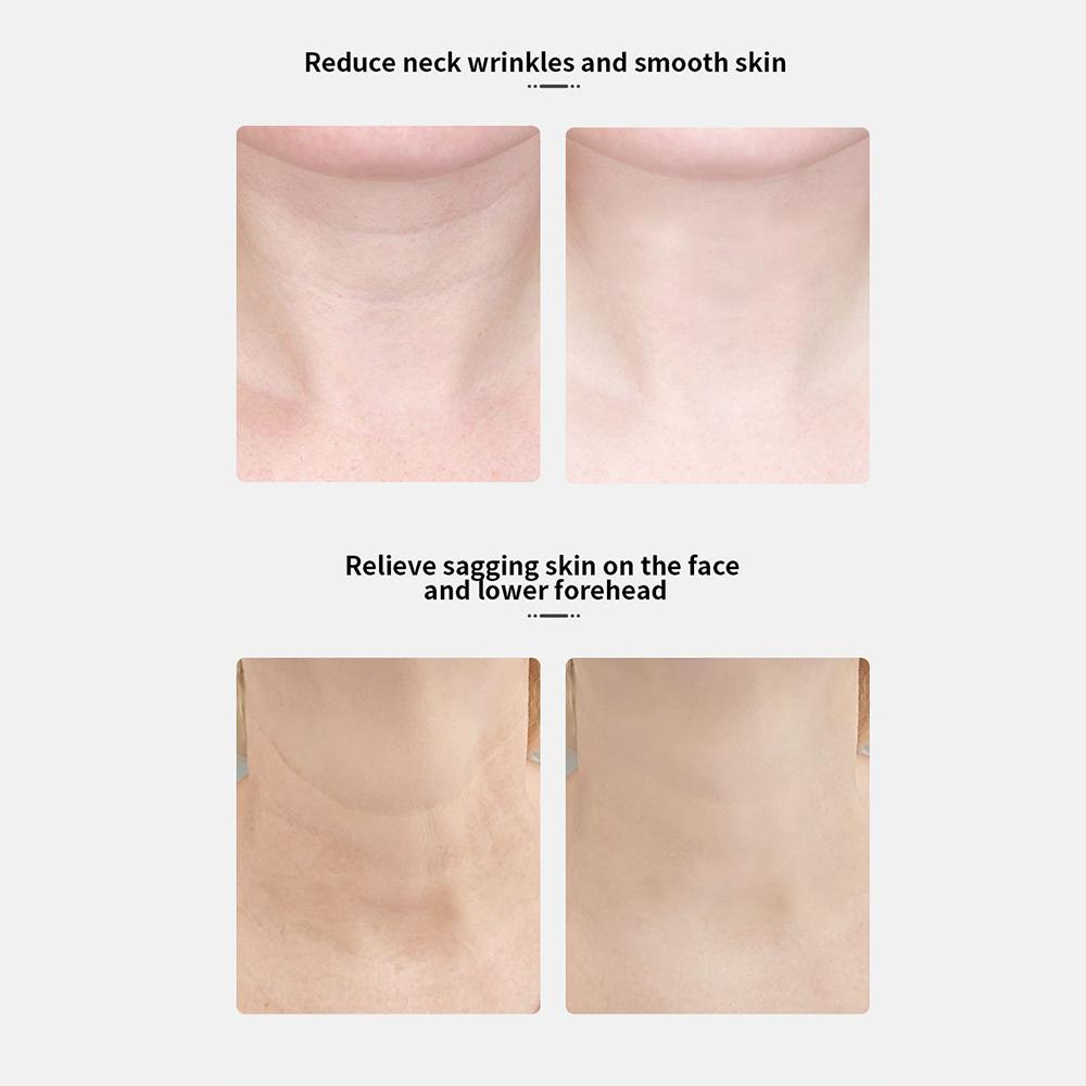 EMS Microcurrent Neck Face Massager Electric Neck Beauty Device Electric Wrinkle Remover Lifting Face Anti Wrinkle Remove Skin Cosmetology Equipment
