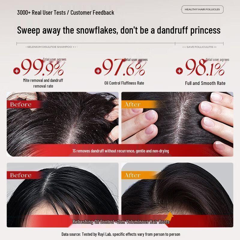 RUYI Selenium Disulfide Dandruff & Oil Control Shampoo