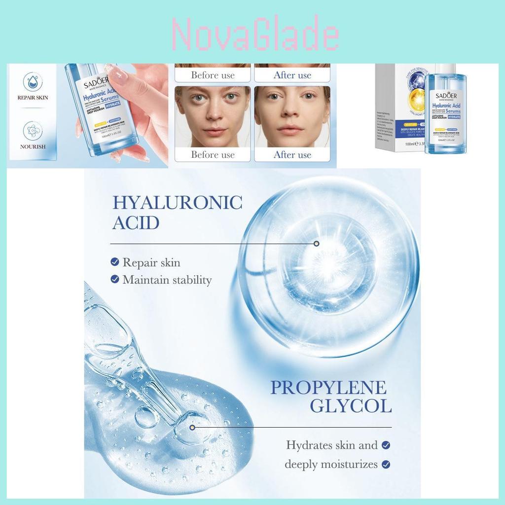 Sadoer Hyaluronic Acid Essence 100ml Ultra Hydrating And Pore Minimizing Serum For All Skin Types