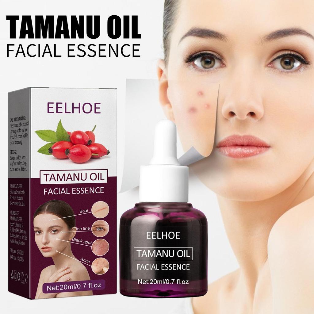 EELHOE Begonia Facial Oil Fades Acne Marks, Lightens Lines, Moisturizes & Firms Skin Essential Oil