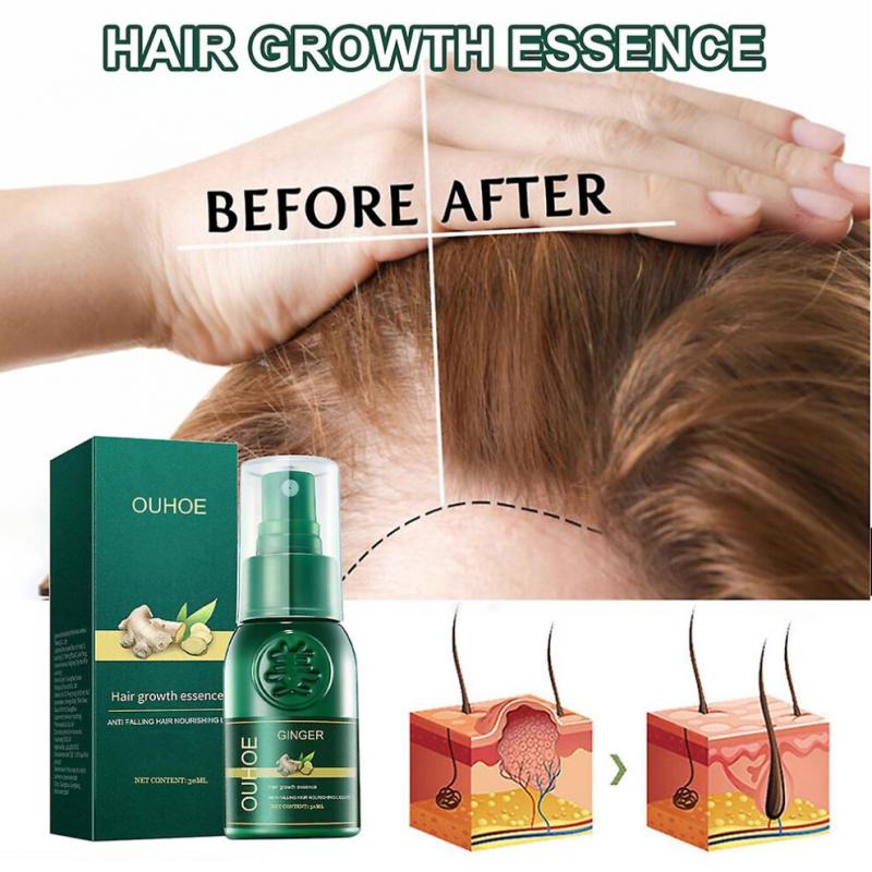 3pcs Ginseng Ginger Hair Regrowth Serum Spray Shougagro Japanese Hair Growth Spray