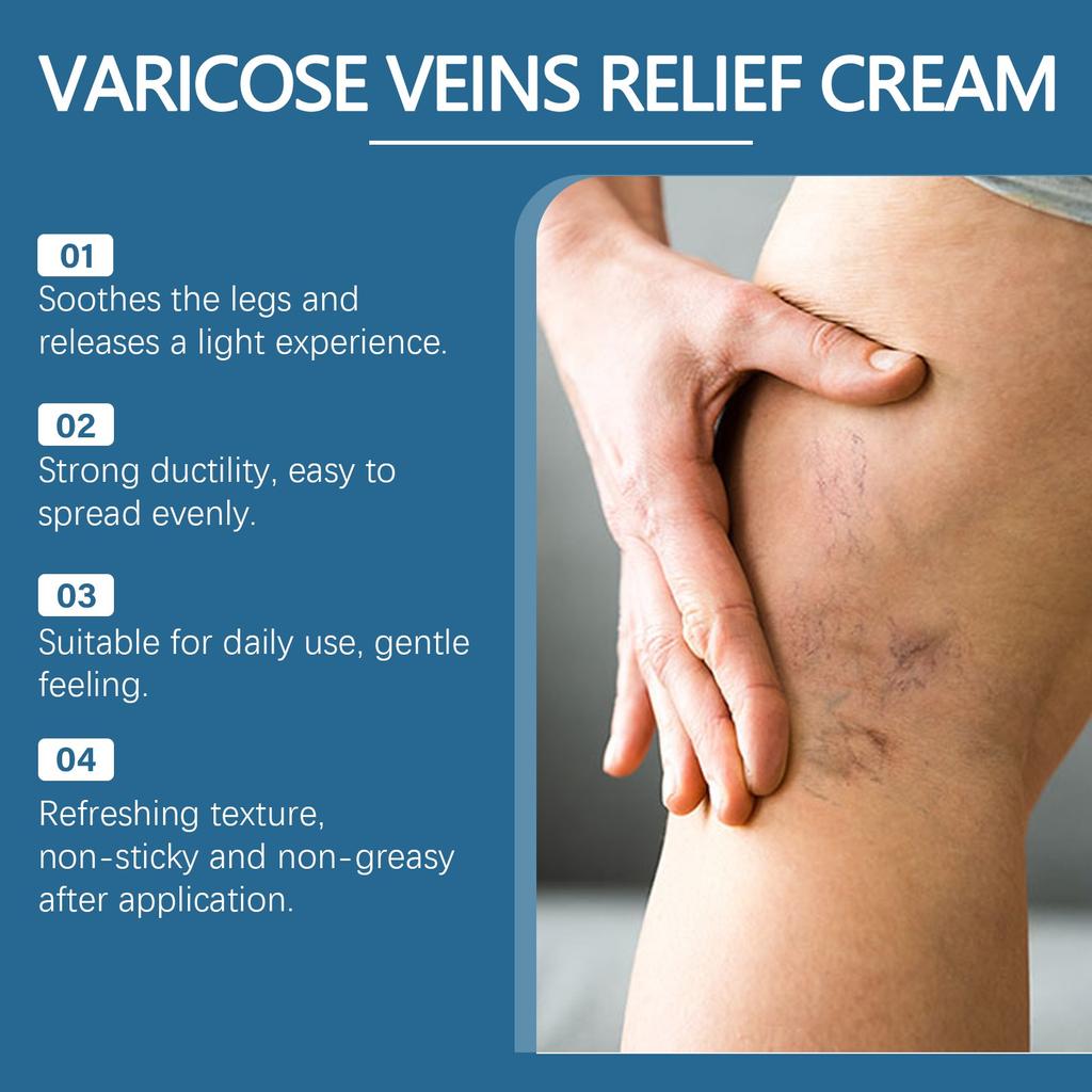 Varicose Vein Relief Cream Leg Massage Care Massage, Blue Veins And Red Blood Vessels  Varicose Veins,  Leg Fatigue And Soreness, Reduce Swelling A