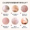 For Over 20 Years of Pore Sowan C Dermamix Is the Perfect Serum for Treating Strawberry Nose and Enlarged Vitamin Pore Tightening Supply 3 Troubles,