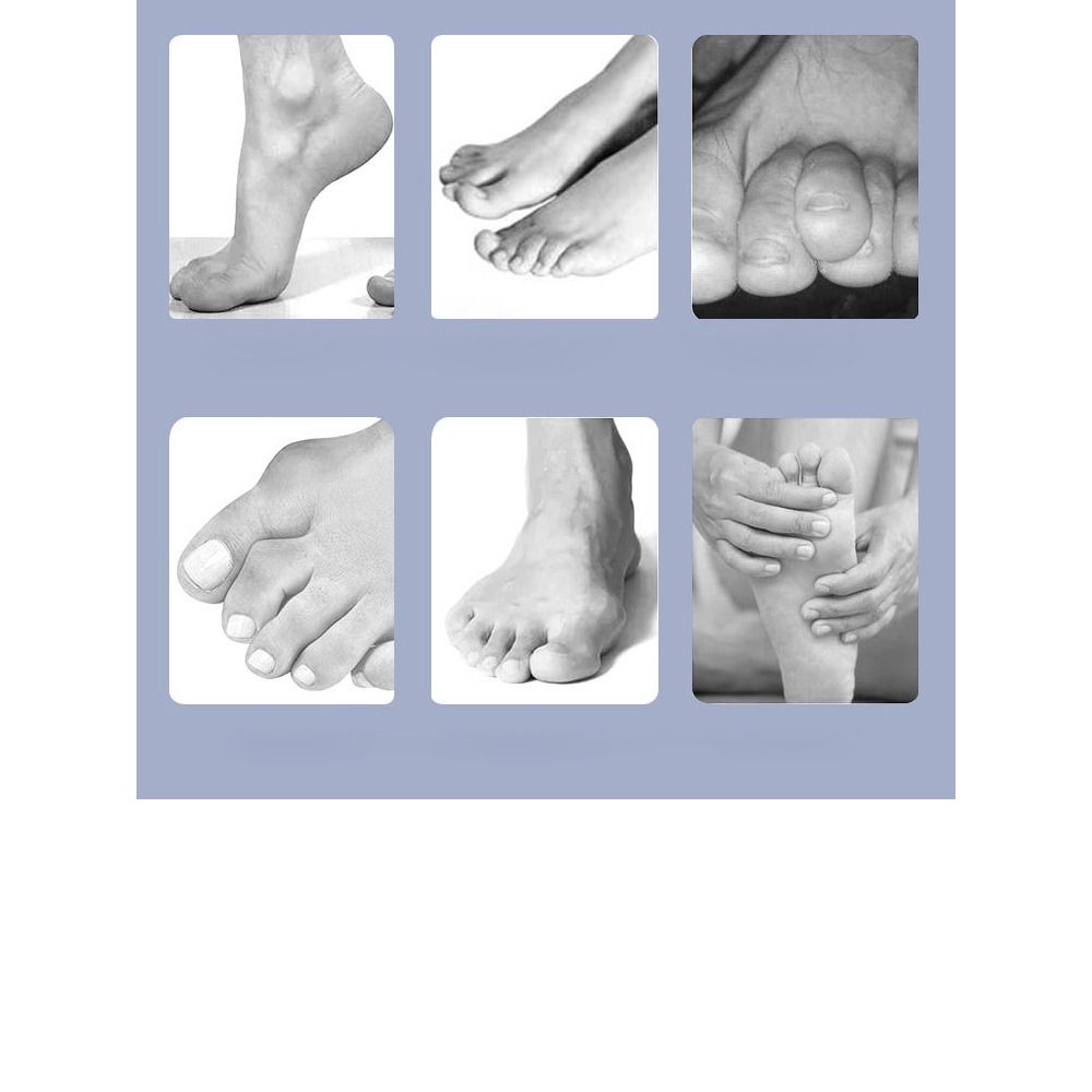 Supportive Toe Strap Soft Toe Fixation Clamp Fixed Clamp Foot Support  Men Women