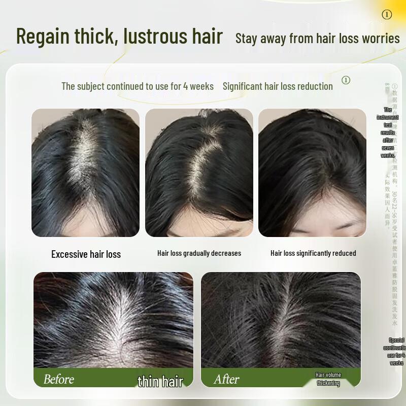 Zhuolanya Anti-Hair Loss Ginger Shampoo