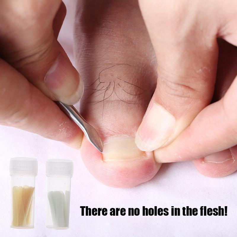 50Pcs/Box Pedicure Foot Toe Nail Ingrown Toenail Correction Tool Nail Treatment Elastic Sticker Straightening Foot Care Tools