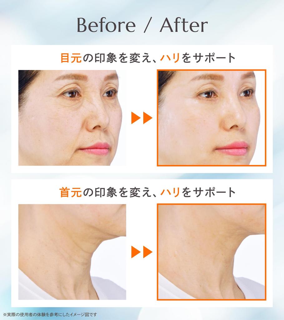 in See results in 30 seconds Exosome wrinkle improvement cream serum RepitSerum 4 million units sold PDRN Spicule Korean cosmetics care 6ml RepitSerum