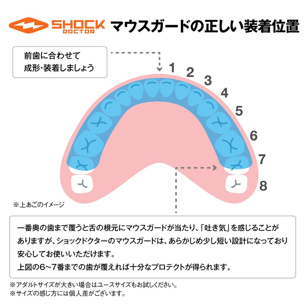 ShockDoctor Mouthguard 6901A GELMAX POWER Molded Protection Sports Training Martial Arts Adult Carbon