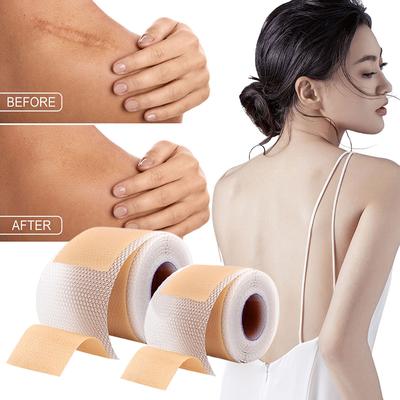 Silicone Scar Patch Nude Scar Tape Roll Scar Sheet Removal Self-Adhesive Tape Therapy Patch Burn Acne Surgical Scar Skincare