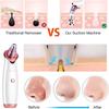 USB Rechargeable Pore Cleanser 3 Suction Levels Blackhead Extractor with 5 Heads Skin Care Tool