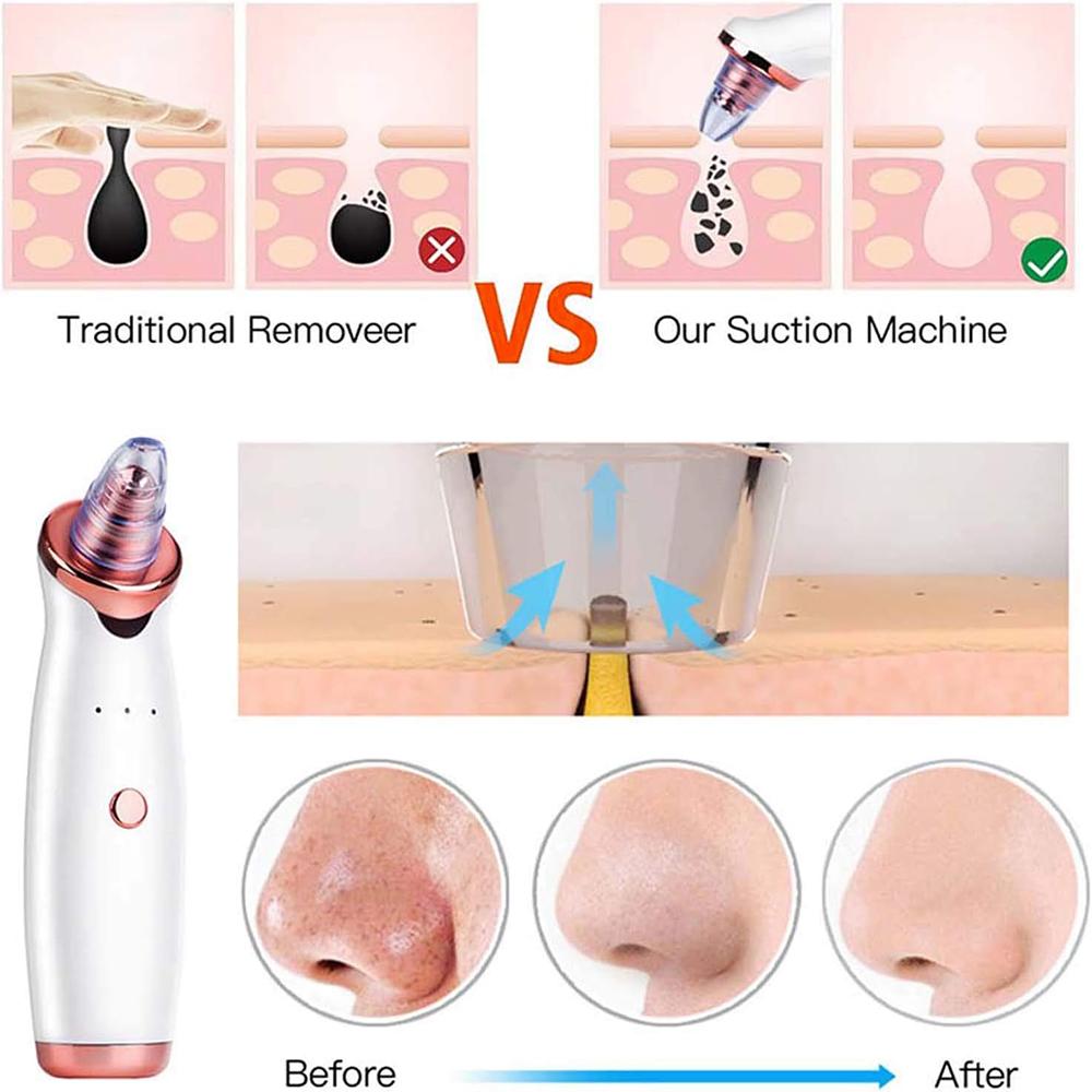 USB Rechargeable Pore Cleanser 3 Suction Levels Blackhead Extractor with 5 Heads Skin Care Tool