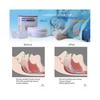 ANTI SNORING MOUTH GUARD, Device Sleep Aide Adjustable Mouth-Free Buds,Xmas Gift