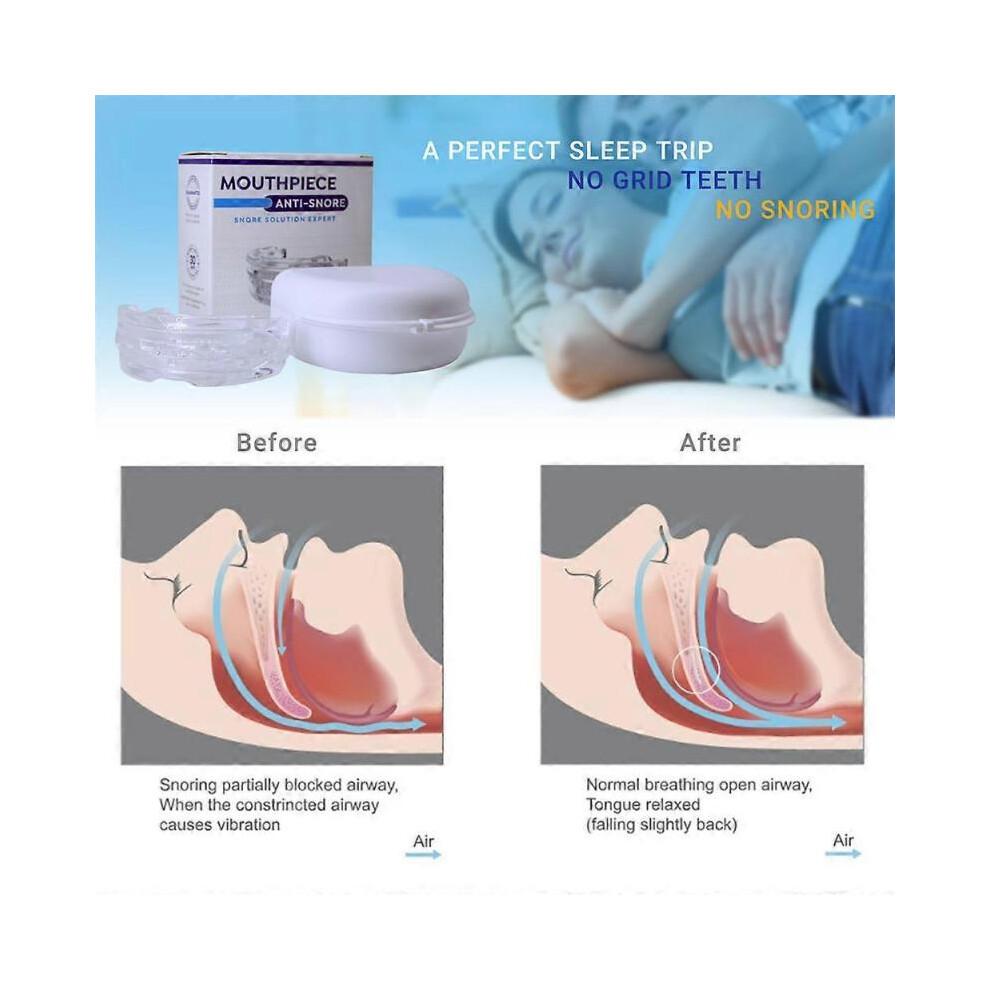 ANTI SNORING MOUTH GUARD, Device Sleep Aide Adjustable Mouth-Free Buds,Xmas Gift
