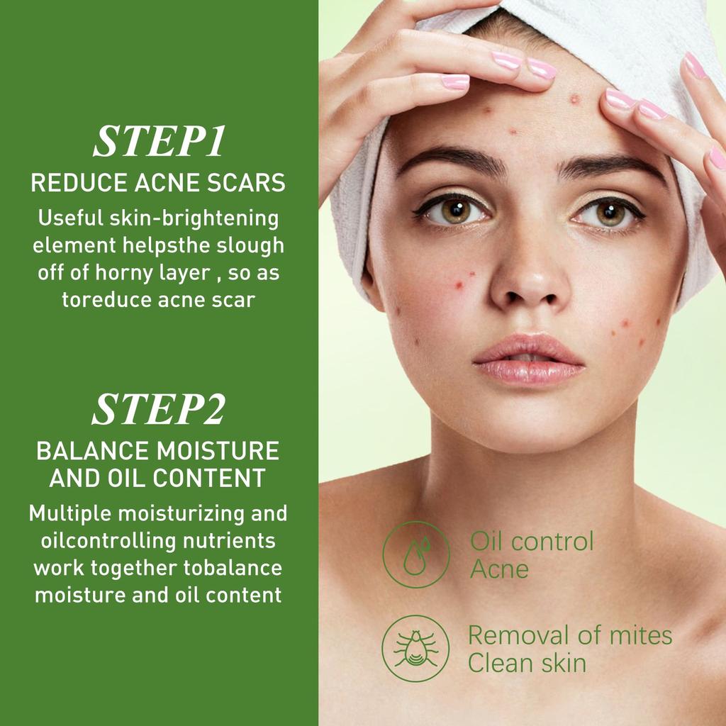 Acne Oil, Olive Oil, Acne Cleansing Oil, Acne Scar Lightening Olive Oil, Skin Care Oil ,30ML