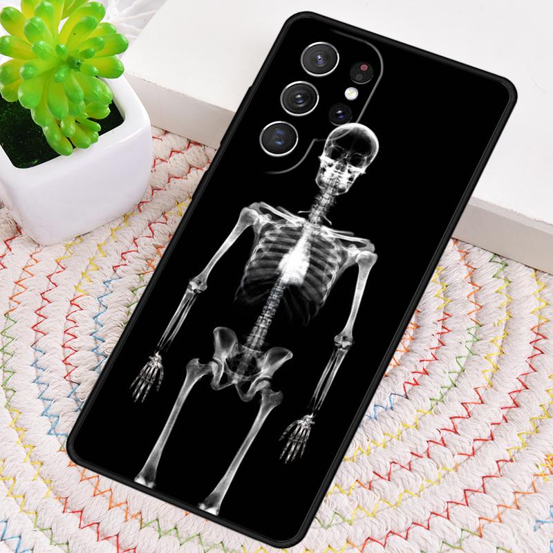 X-Ray Human Anatomy TPU Phone Case For Samsung Galaxy Note 10 Pro S26 S25 S24 S23 S22 Ultra Plus S21 FE S20 Shockproof Cover