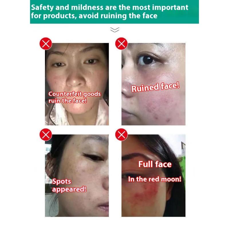 Fengying Elasmizing Essence Fills Apple Muscle Fengface Essence Huafeng Forehead Tear Groove Lifting