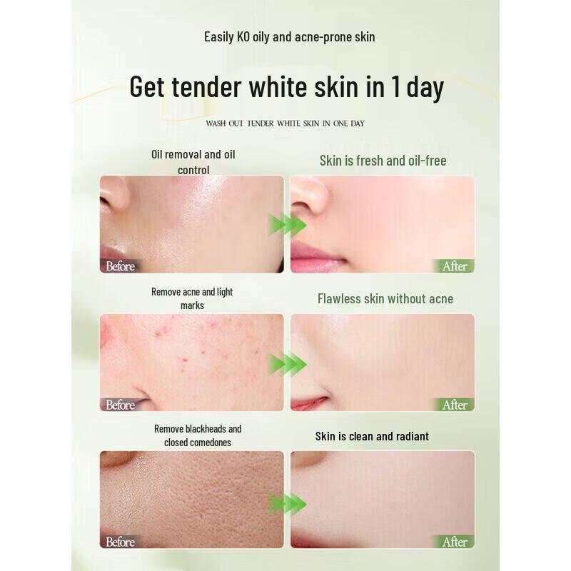 Ruyi Amino Acid Facial Cleanser for Oil Control and Acne