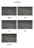 Pure Titanium Men's Square Rimless Myopia Glasses with Vacuum IP Electroplating
