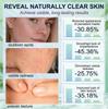 Salicylsäure Porenverfeinernde Creme 30g, Gesichts Hautglättende Creme, Poren verfeinern, Sanfte Peeling-Creme für raue & zu Unreinheiten neigende Haut
