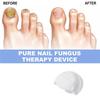 A04V Lasers For Nail Fungus Treatment Device Onychomycosis Cleaning Foot Repair Fungi Fungal For Nails Removal Anti Mushroom
