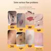 Invisible Tattoo & Scar Cover Patch - Waterproof Flesh-Colored Concealer for Birthmarks, Stretch Marks, Moles, and Vitiligo
