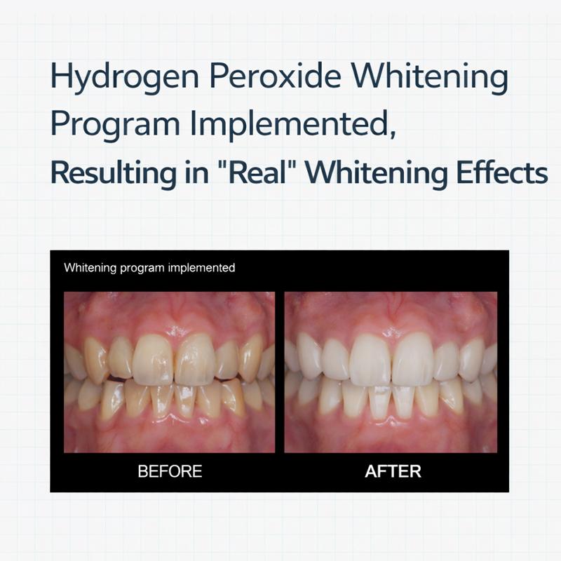 TOSOWOONG Отбеливающий карандаш для зубов 2 шт.