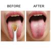 Tongue Scraper 2 Pack In Different Shapes Reduce Bad Breath Stainless Steel Tongue Cleaners Metal