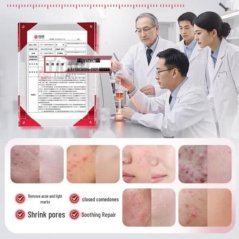 Vitex Azelaic Acid 15% Acne Treatment Gel