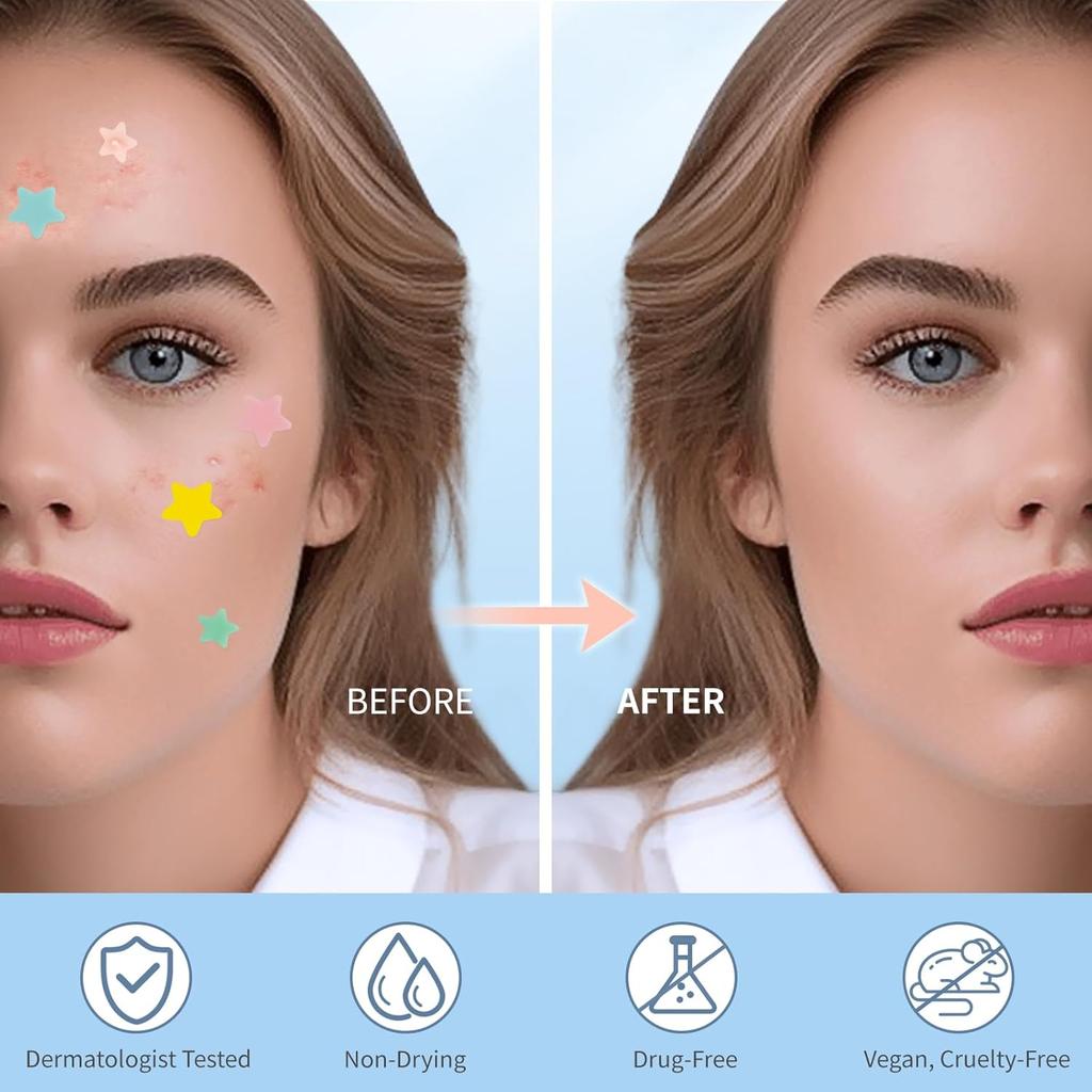 Pimple Patches for Face, Hydrocolloid Acne Patches, Cute Star Zit Covers, Colorful Spot Stickers with Tea Tree, Salicylic Acid & Cica Oil| 28 Pcs