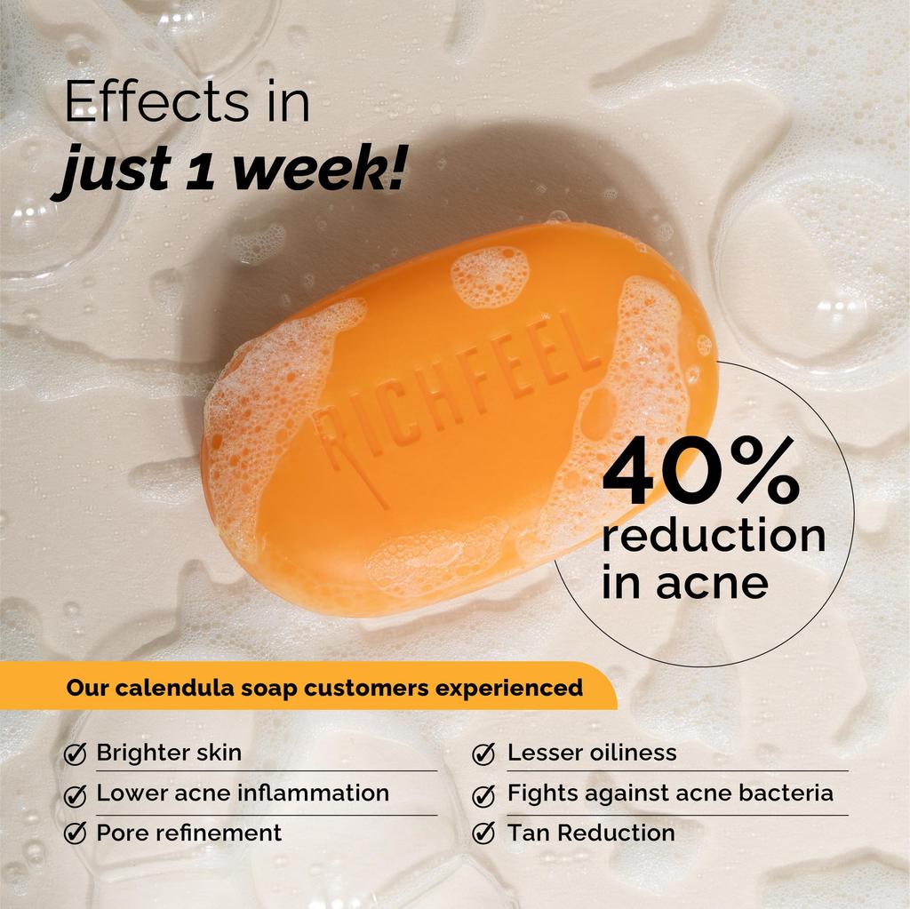 Richfeel Calendula Acne Soap, 75g (Pack of 3)
