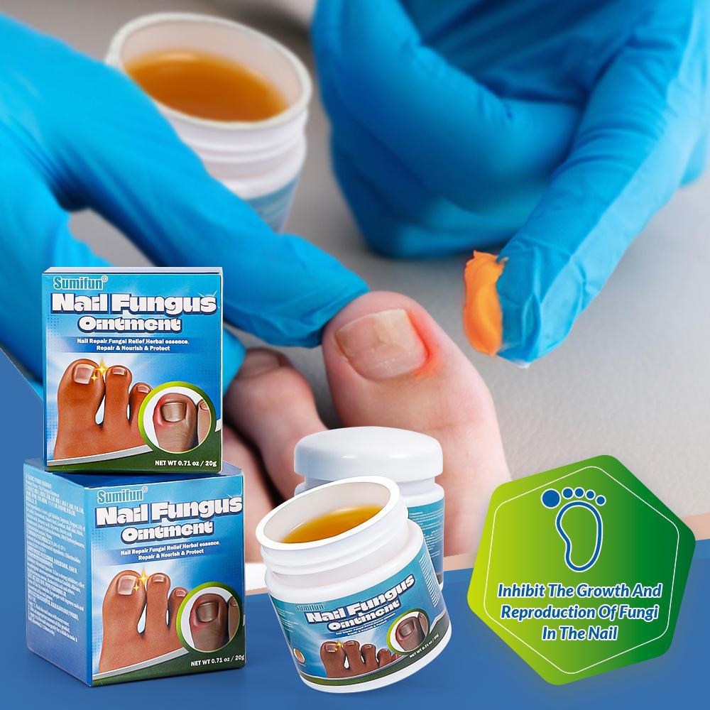 Sumifun 1 Pc Onychomycosis Nail Repair Cream Solution Remove Toenail Fungus Paronychia Nourish Moisturize Nails for Thick,Discolored,Cloud