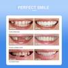 Cosmetic Teeth: 1 Unit Gel Denture Cover - Natural Looking Smile Makeover Teeth Whitening Set for Oral Care Confidence