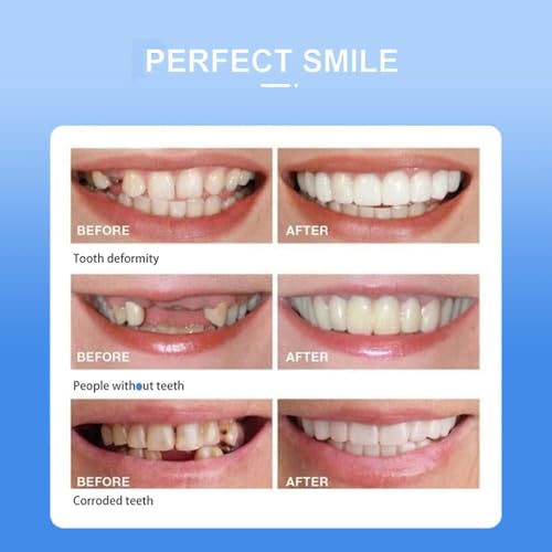 Cosmetic Teeth: 1 Unit Gel Denture Cover - Natural Looking Smile Makeover Teeth Whitening Set for Oral Care Confidence