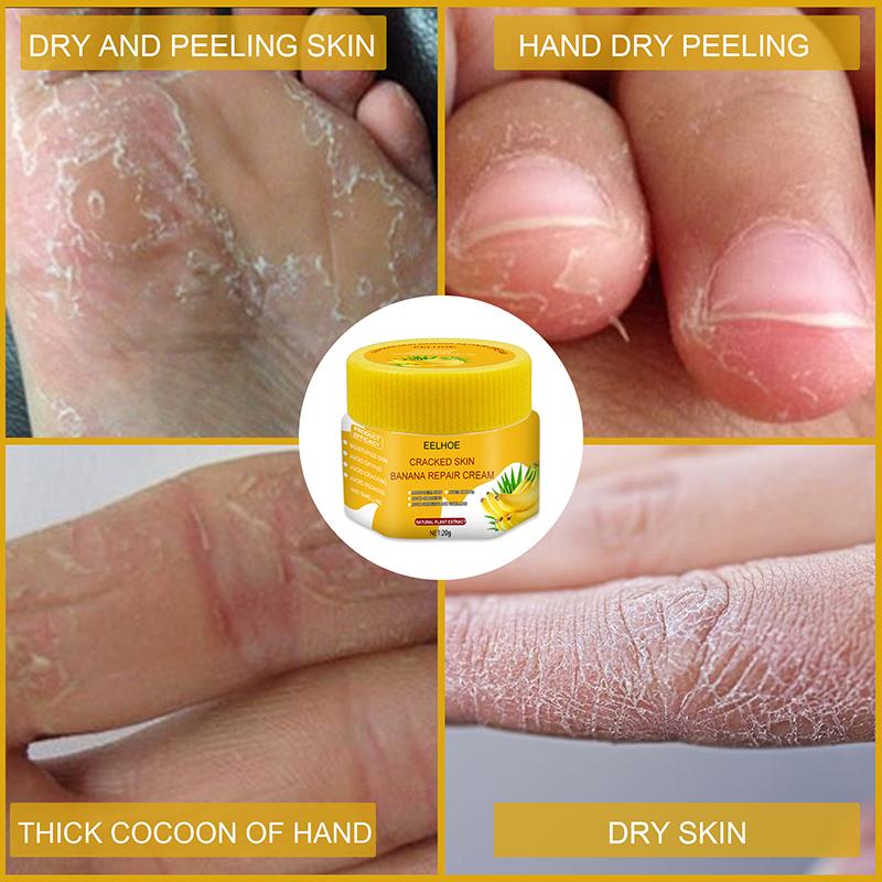 Buy EELHOE 20g Natural Banana Oil AntiDrying AntiCrack Foot Cream