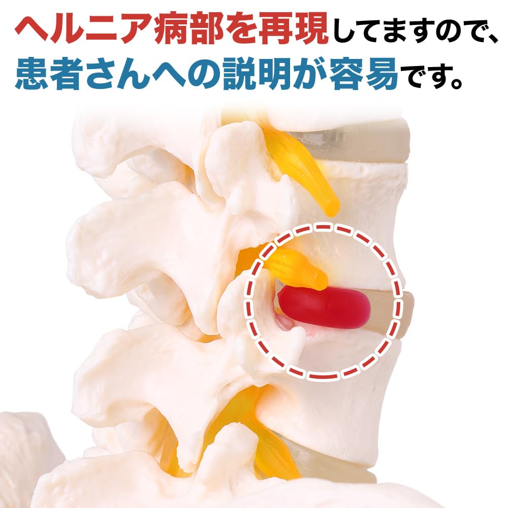 Model pelvin spinal UPstore, mărime naturală, model de coloană vertebrală 90cm, model spinal mobil, dimensiuni 11, model de măduvă spinală suspendată cu piedestal, pelvis masculin mobil